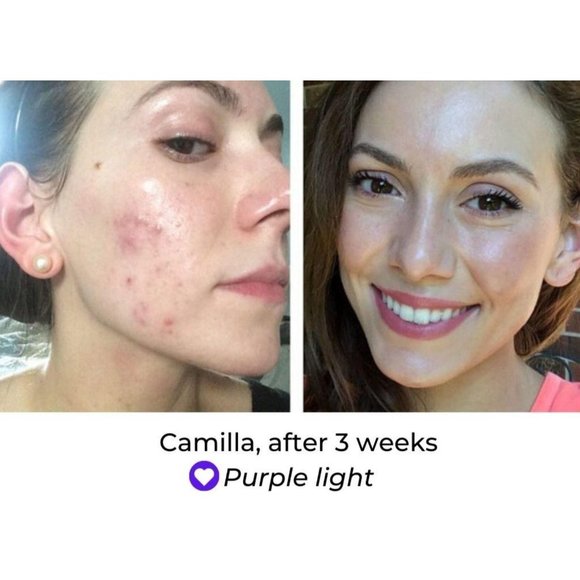 NIB Predire Paris 8 Element Treatment Led Mask - Picture 2 of 15